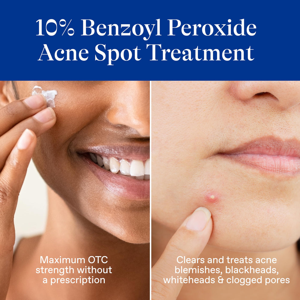 Applying Differin spot treatment to a zit on the skin
