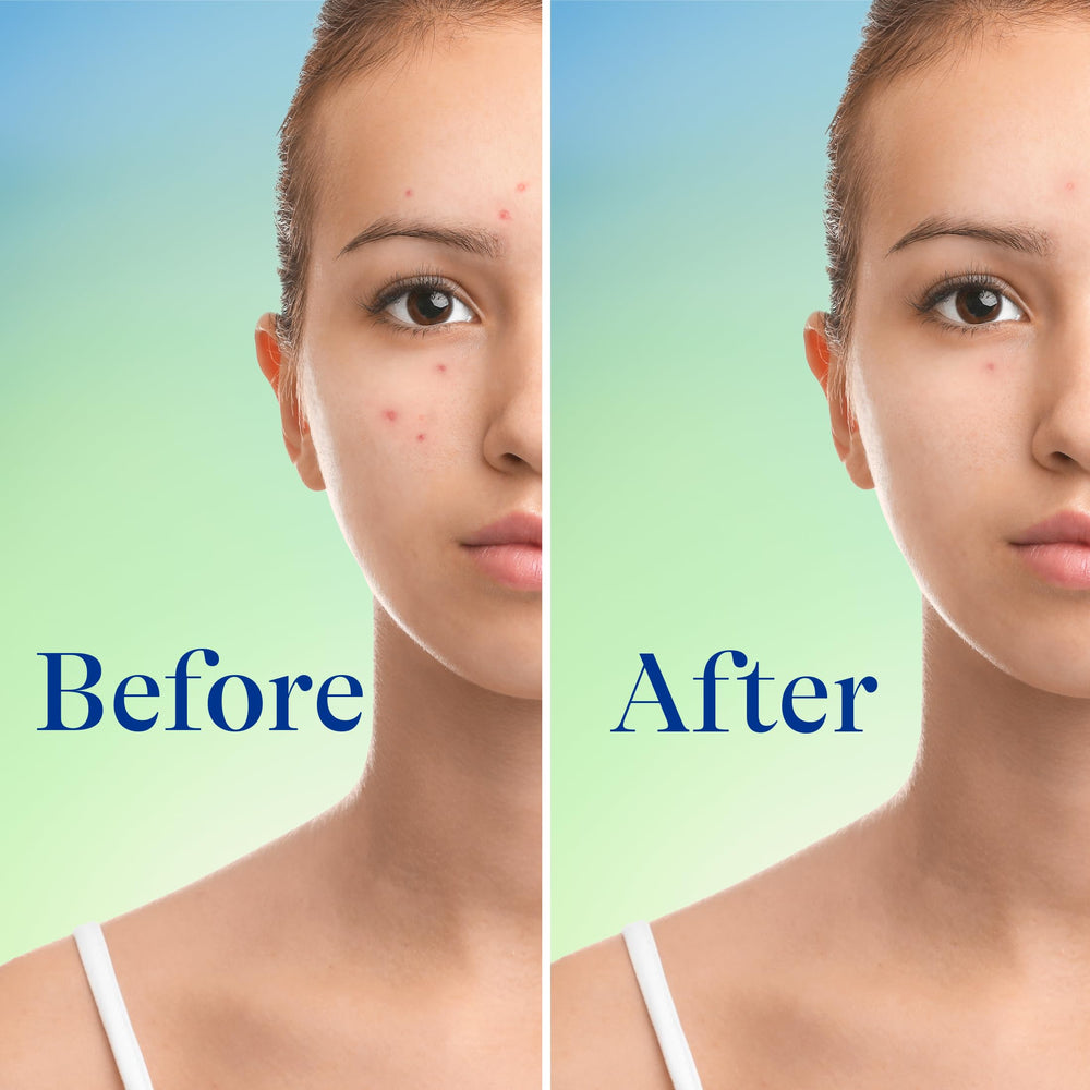Differin bottle with gentle pour to wet skin before cleansing.