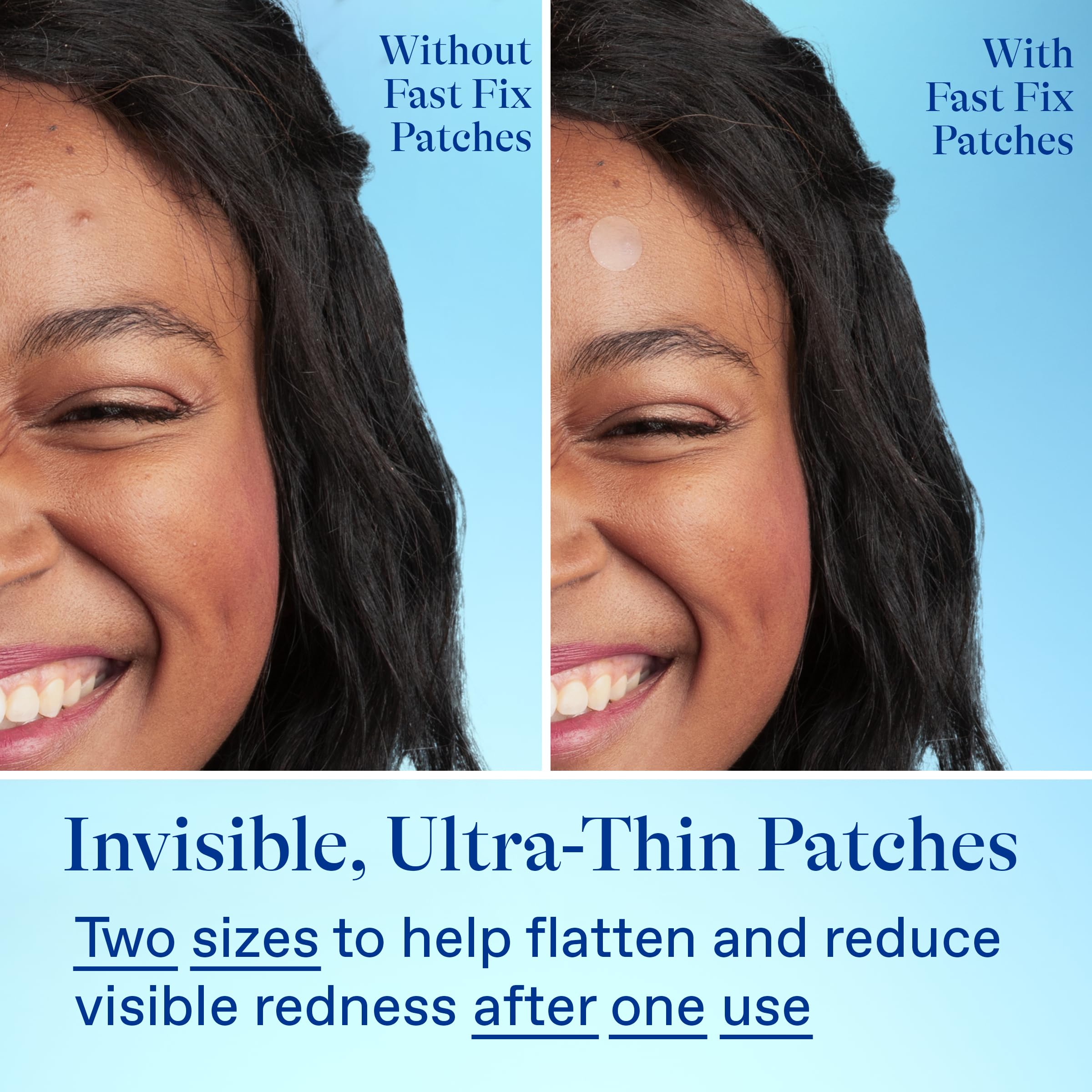 Differin logo visible on dermatologist-tested, vegan-friendly packaging