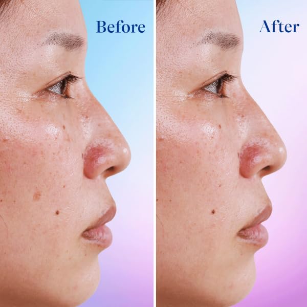 Differin Dark Spot Serum dispense pump enables controlled, precise application.