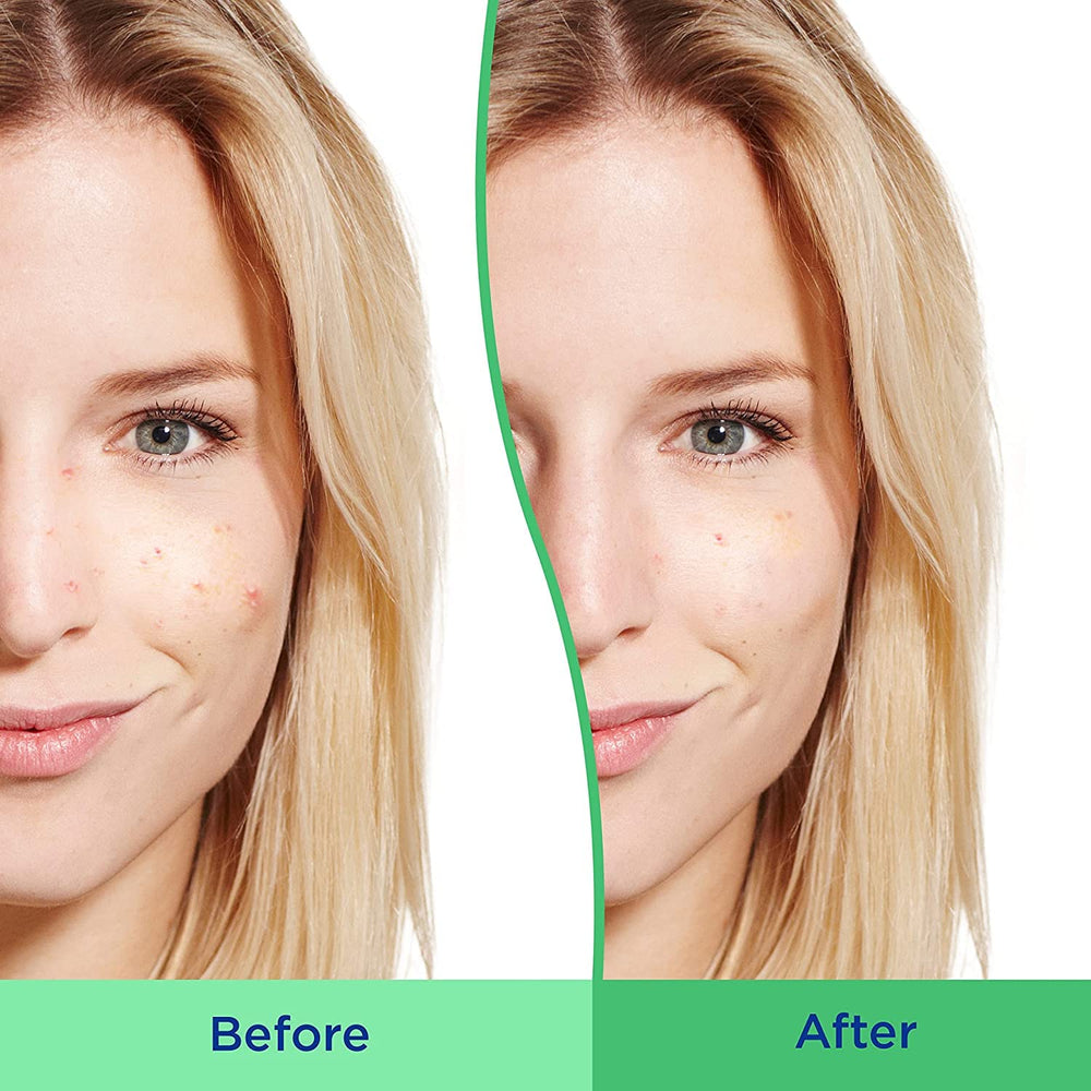 Product shot of Differin Daily Deep Cleanser emphasizing clean, effective care.