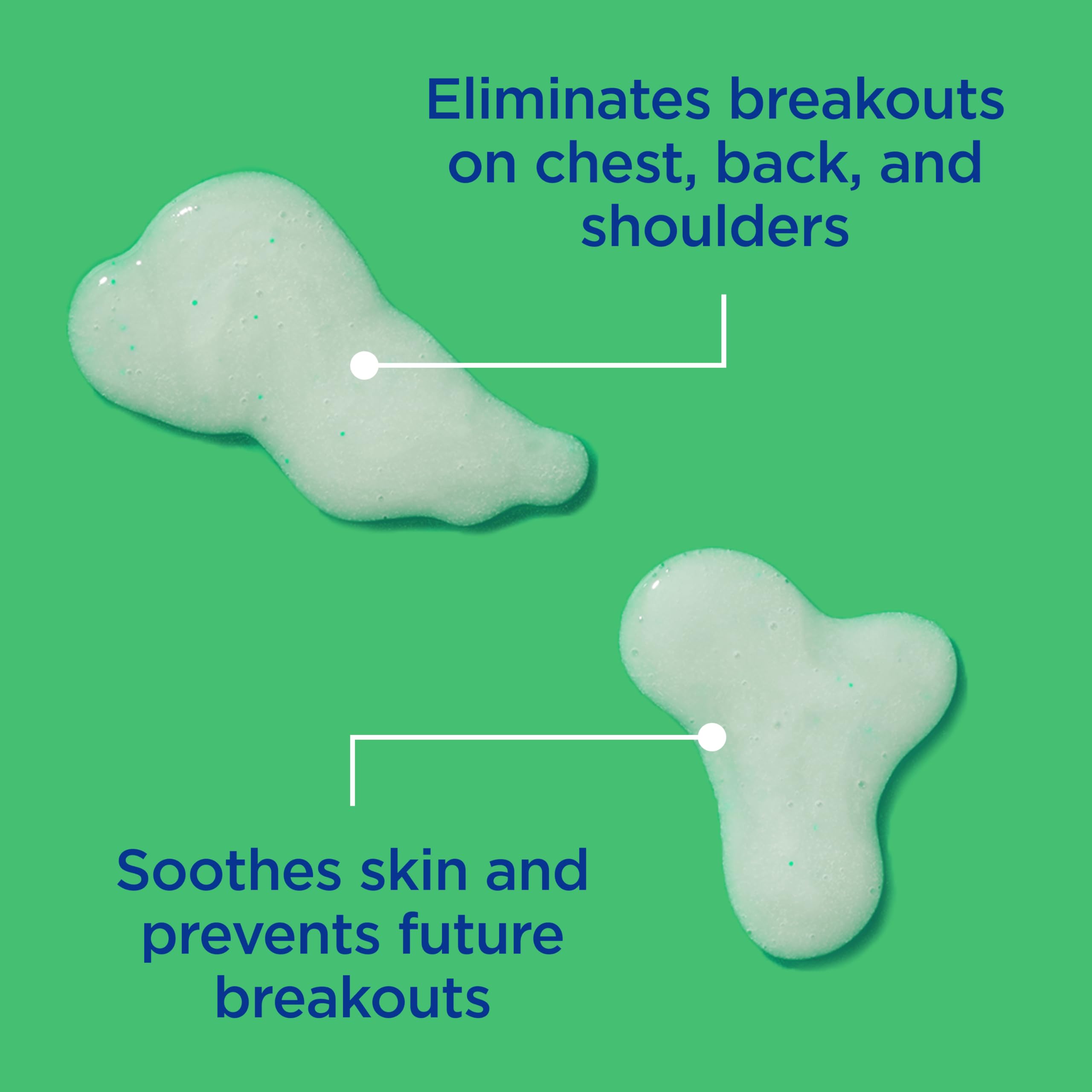 Differin glycolic acid helps fade post-acne marks and discoloration on the skin.