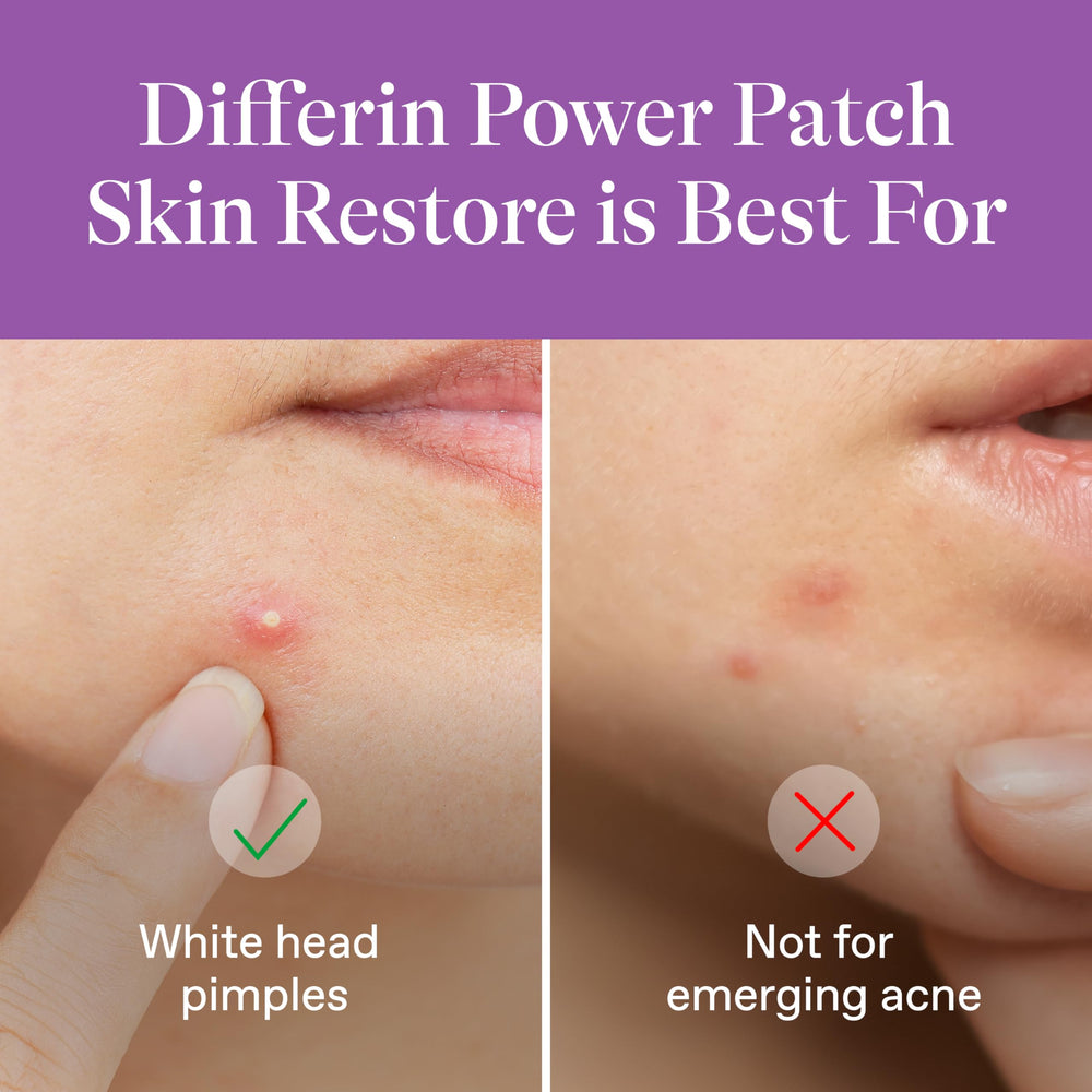 Differin Power Patch 23-count graphic highlights two patch sizes for versatile coverage.