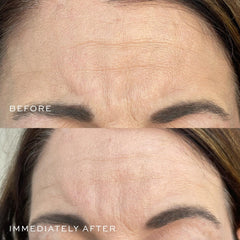 DIME Beauty neck application demonstrating firming target areas