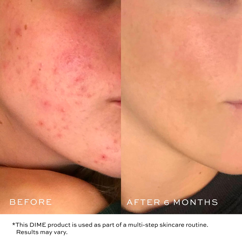 DIME cleanser on damp skin ready to rinse away makeup