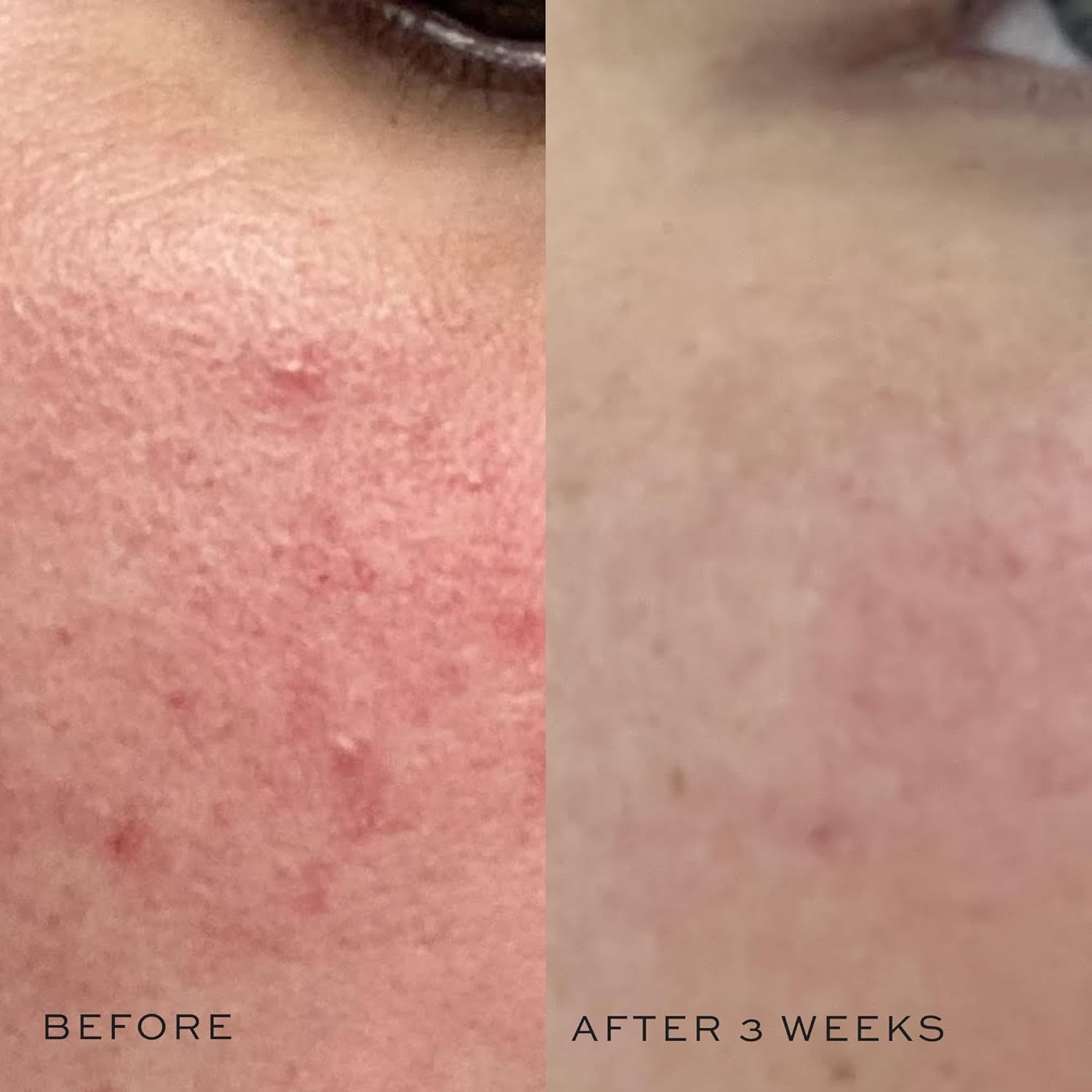 DIME toner with aloe vera for soothing hydration on skin
