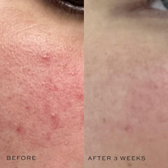 DIME toner with aloe vera for soothing hydration on skin