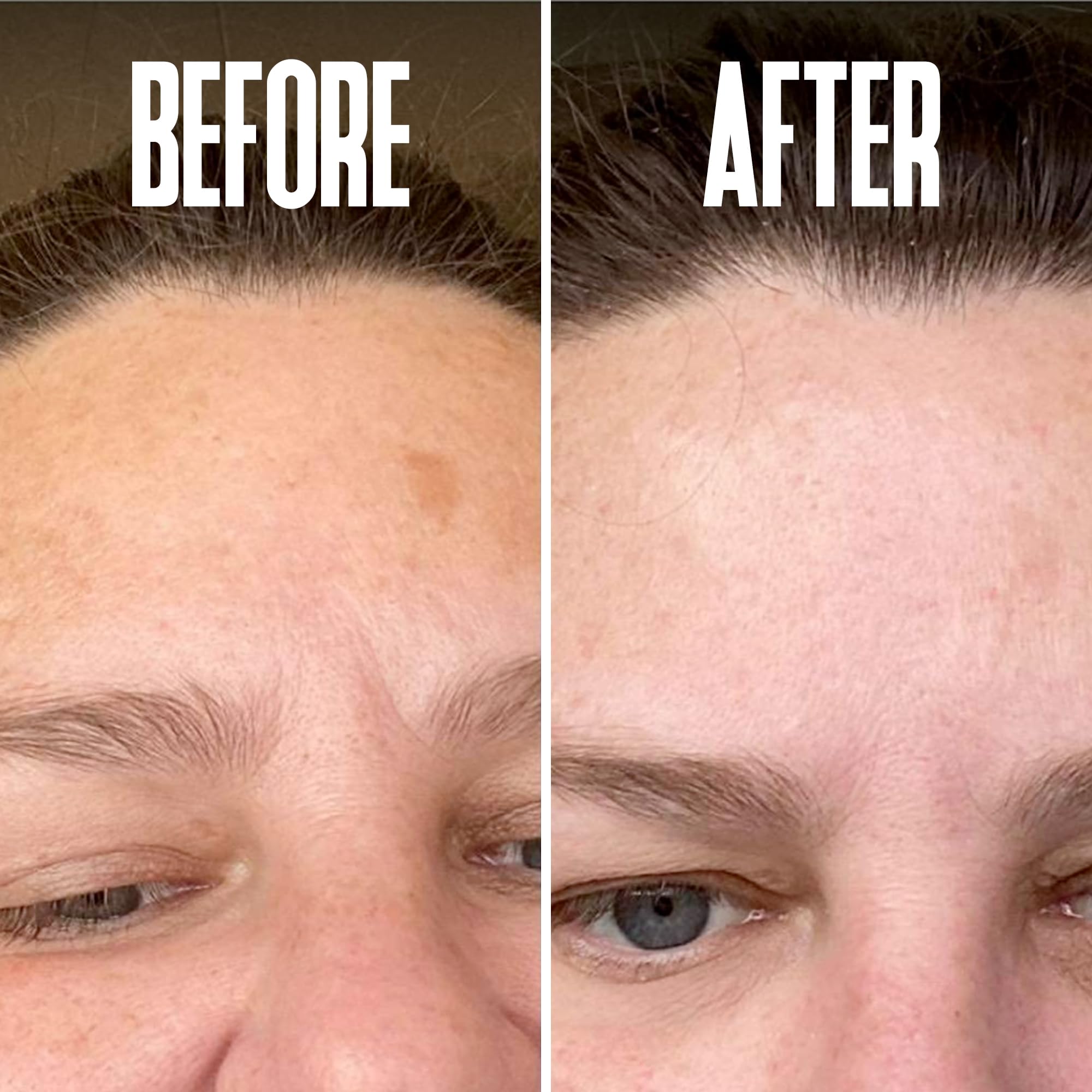 Divine Derriere before-after photos illustrate fading spots and even skin tone.