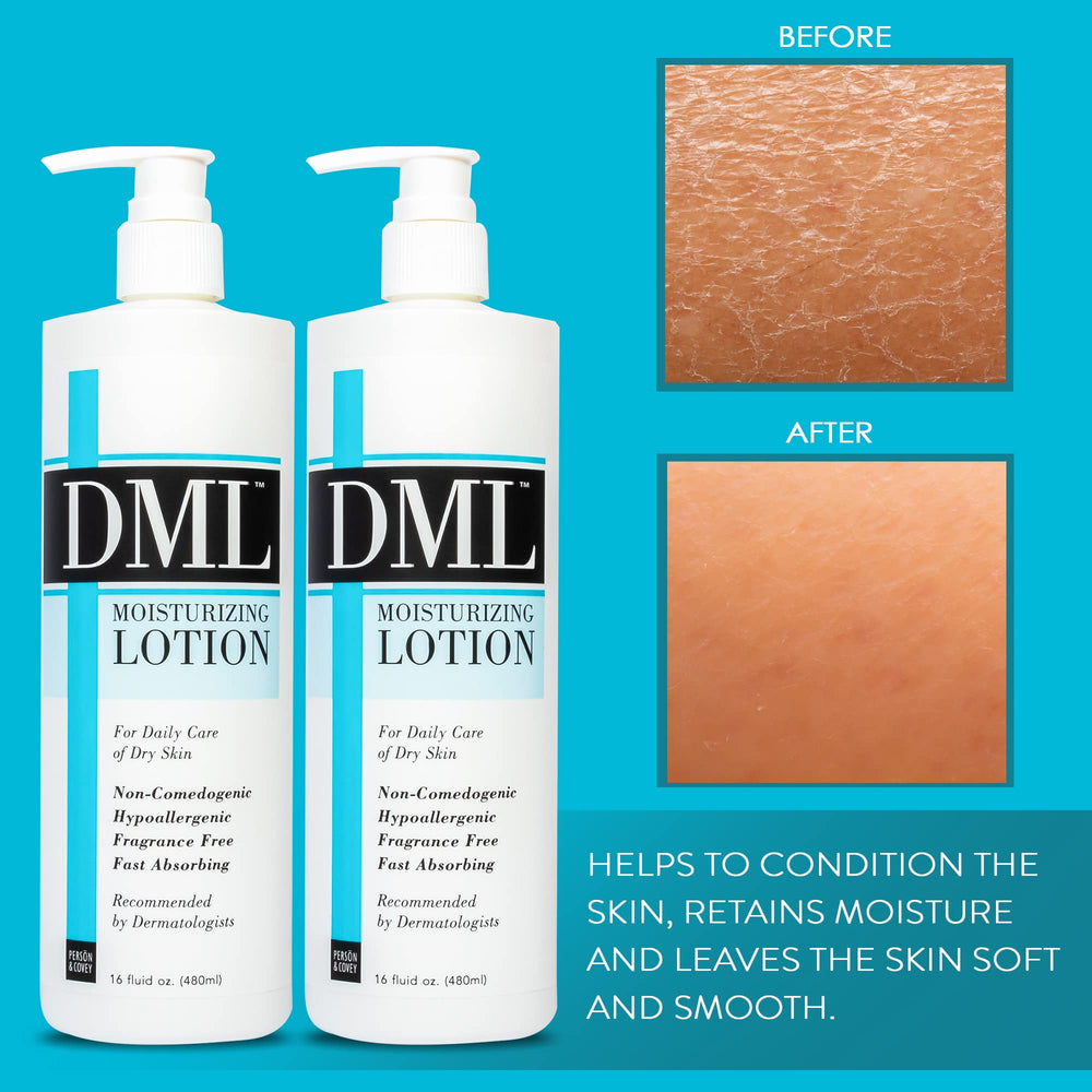 DML Moisturizing Lotion application shows smooth, hydrated hands and body