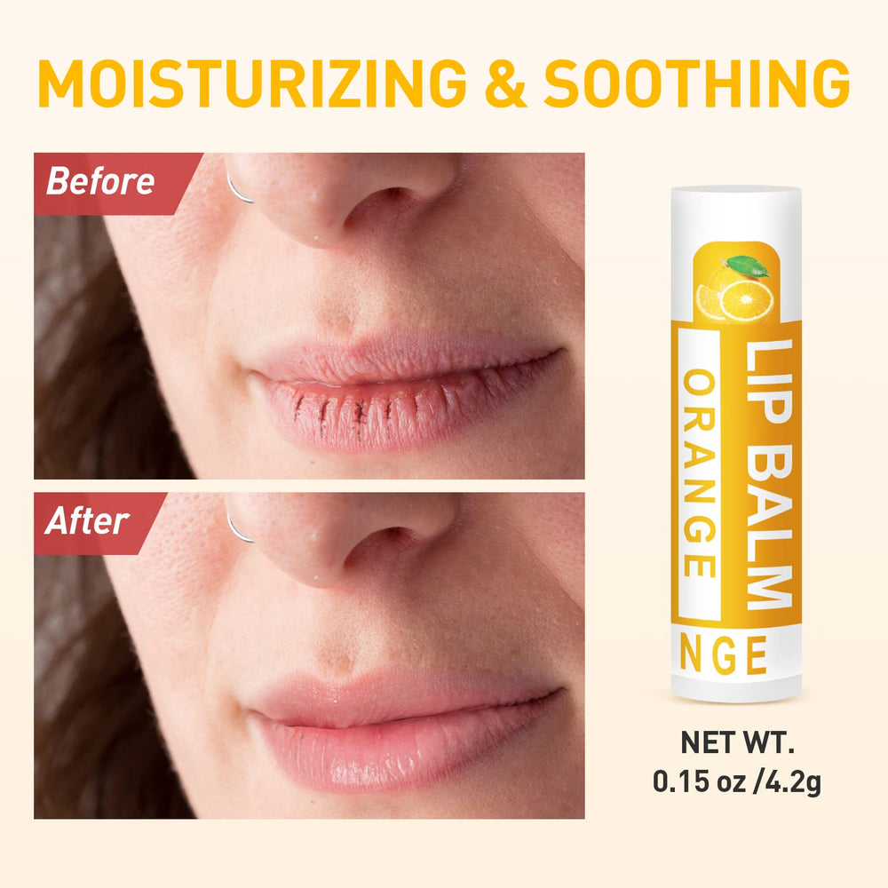 DMSKY lip balm bulk gift-pack—great for gifting and sharing.