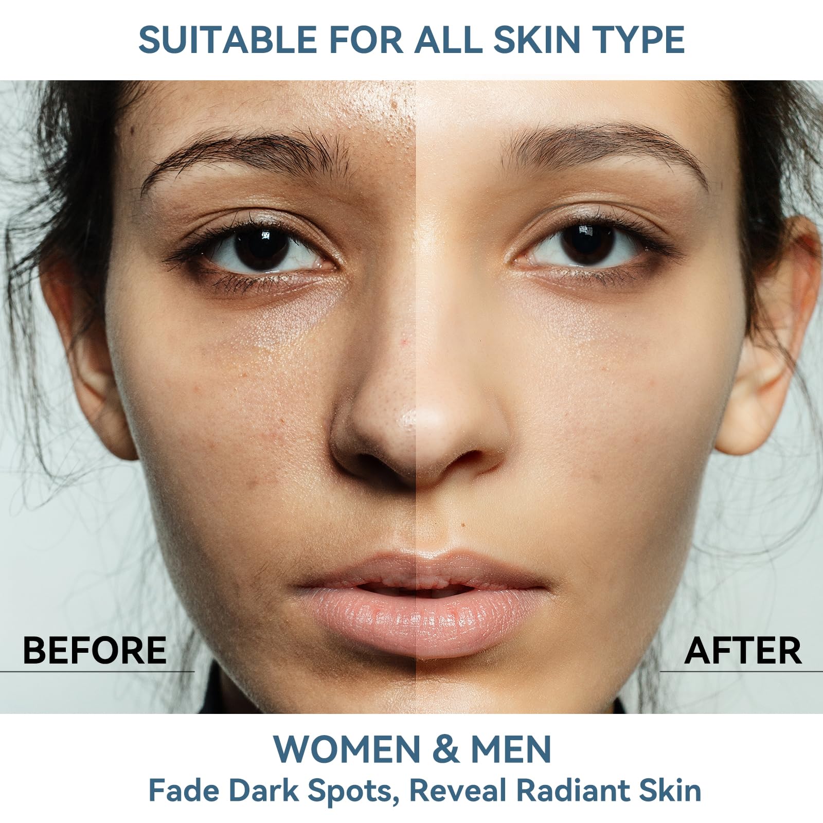 DMYGO dark spot serum dropper dispensing on skin for targeted care.