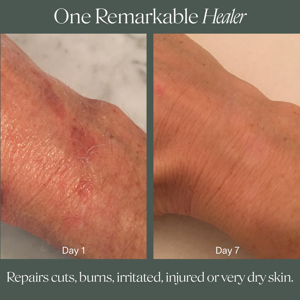 Doctor Rogers Restore Healing Balm infused with hypoallergenic vegan ingredients for gentle care.