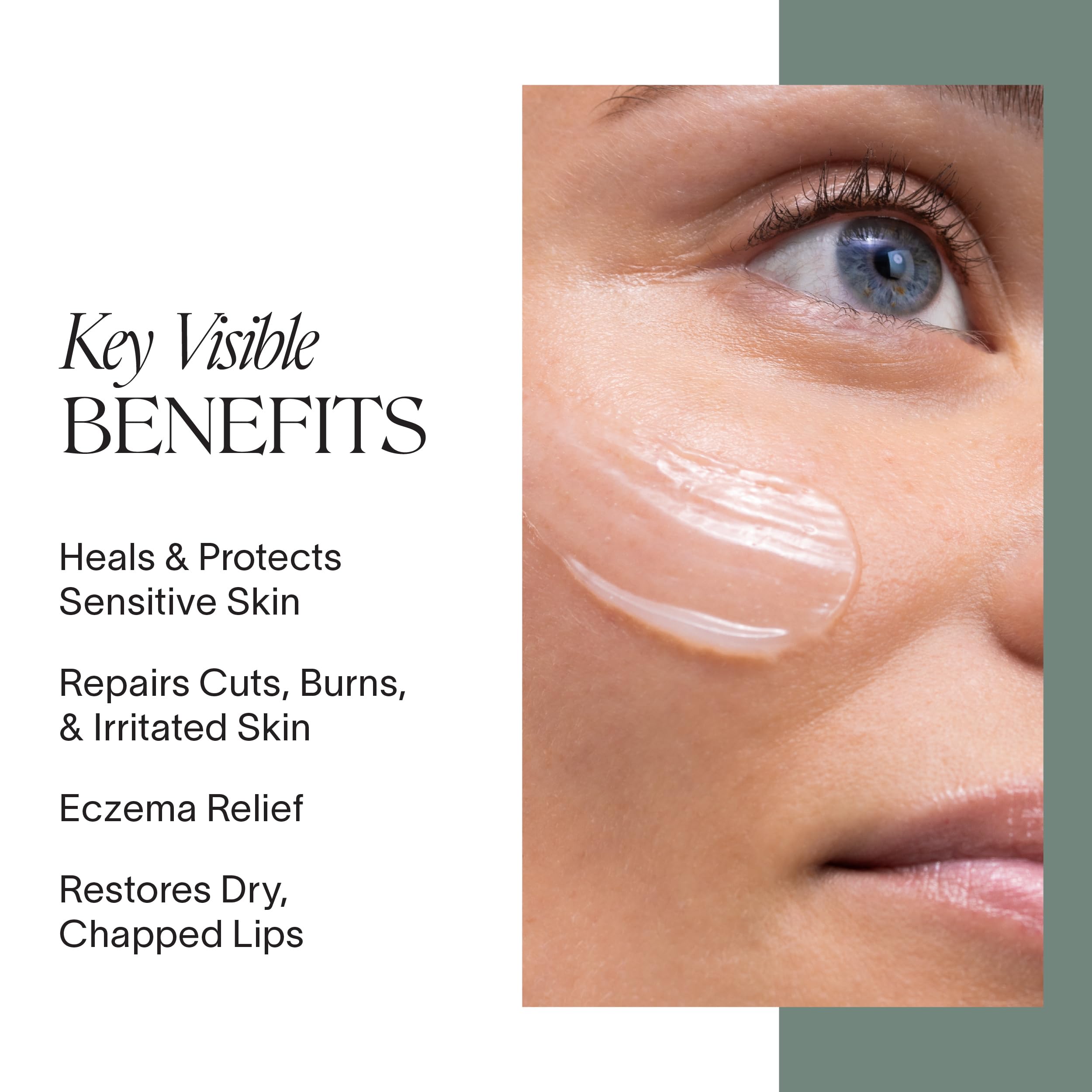 Doctor Rogers Restore Healing Balm on irritated skin provides moisture and a protective layer.