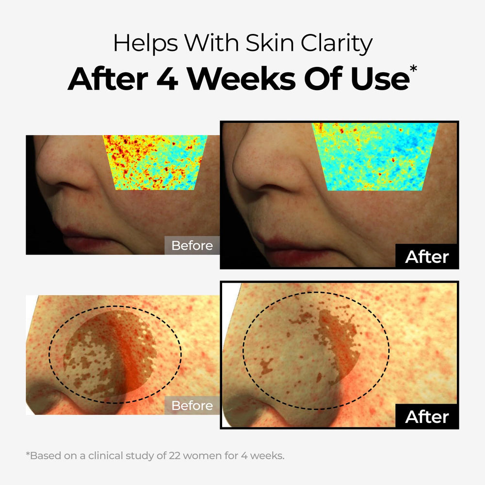 DOMINAS bakuchiol glow detail suggesting gentle anti-aging and renewal