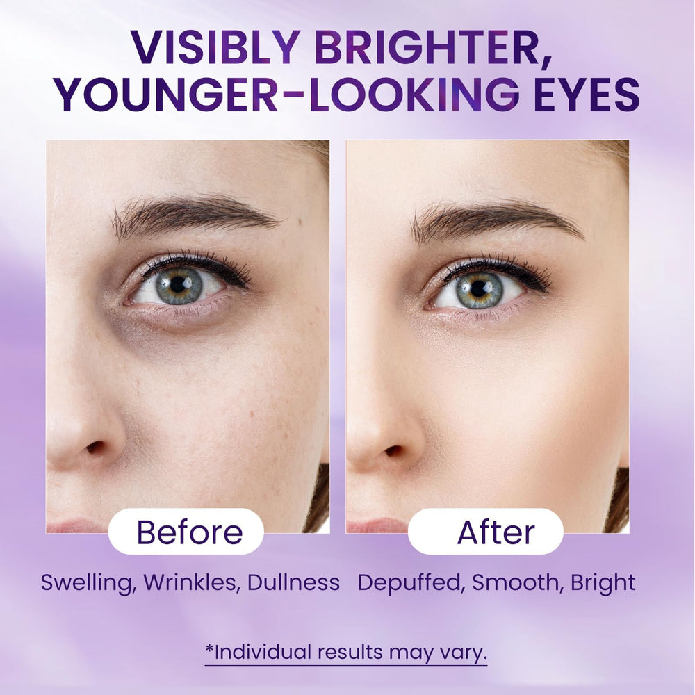 Doracome caffeine-retinol-eye-serum tube closeup highlights compact 0.67 oz size for daily use.