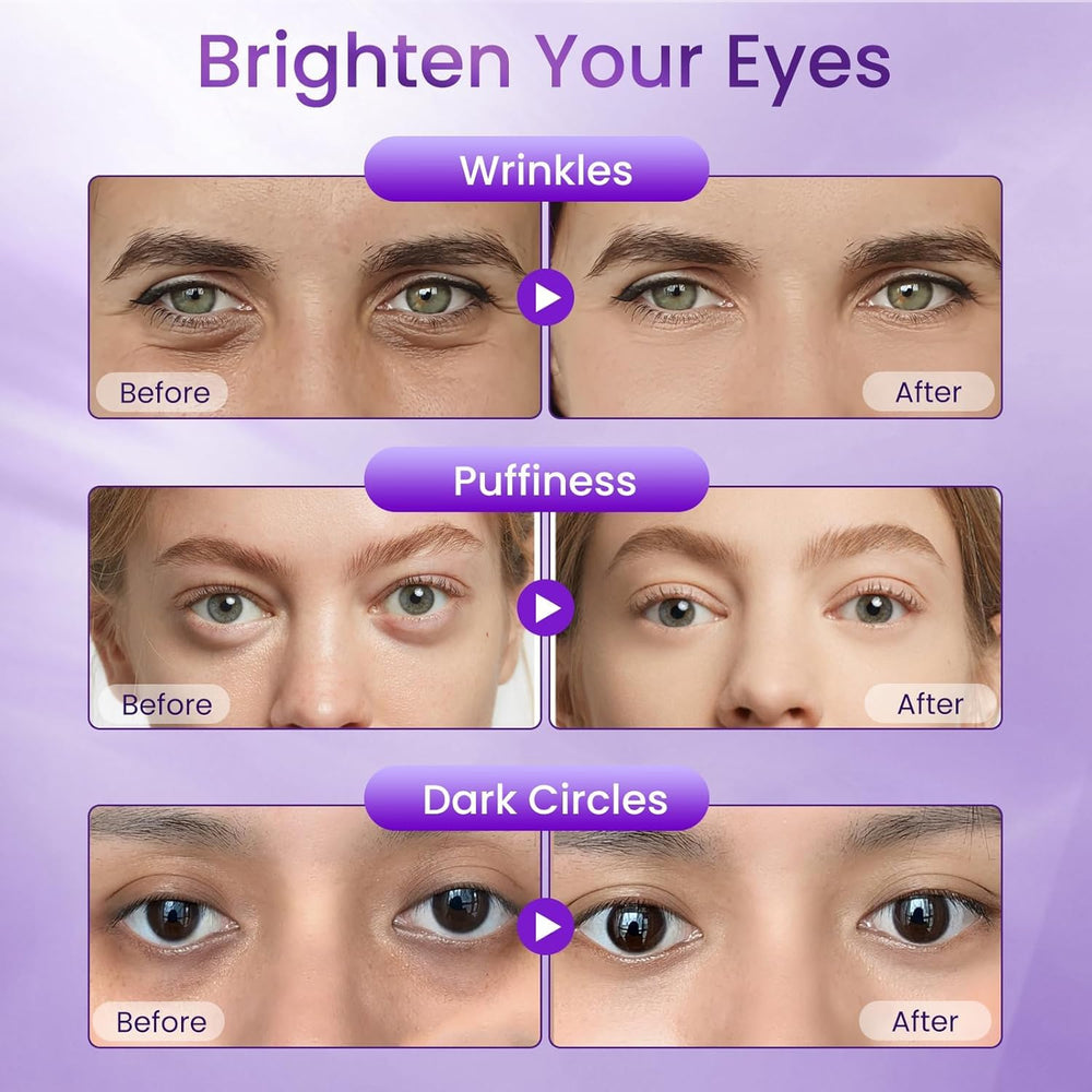 Doracome Retinol Eye Cream with peptides supports skin resilience and barrier around the eyes.