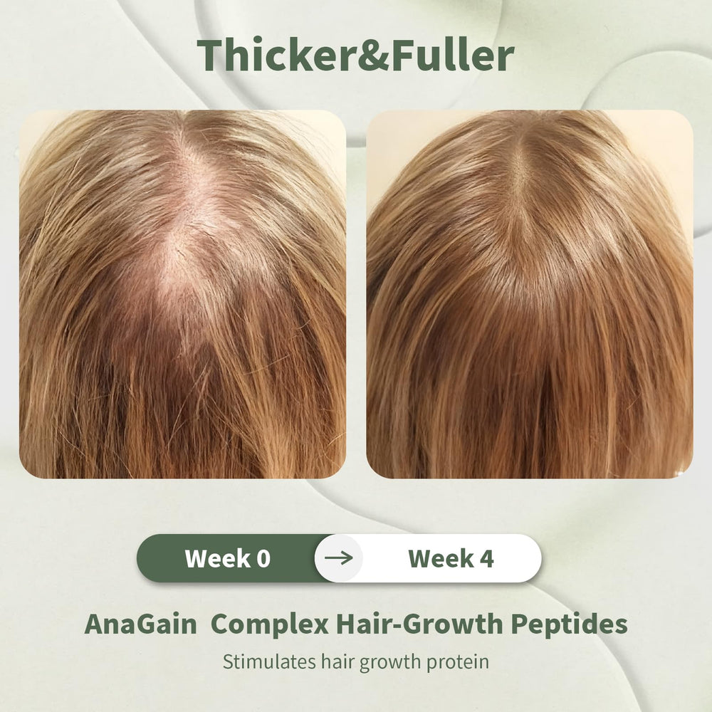 DORPANG ingredients Capixyl and AnaGain promote scalp nourishment.