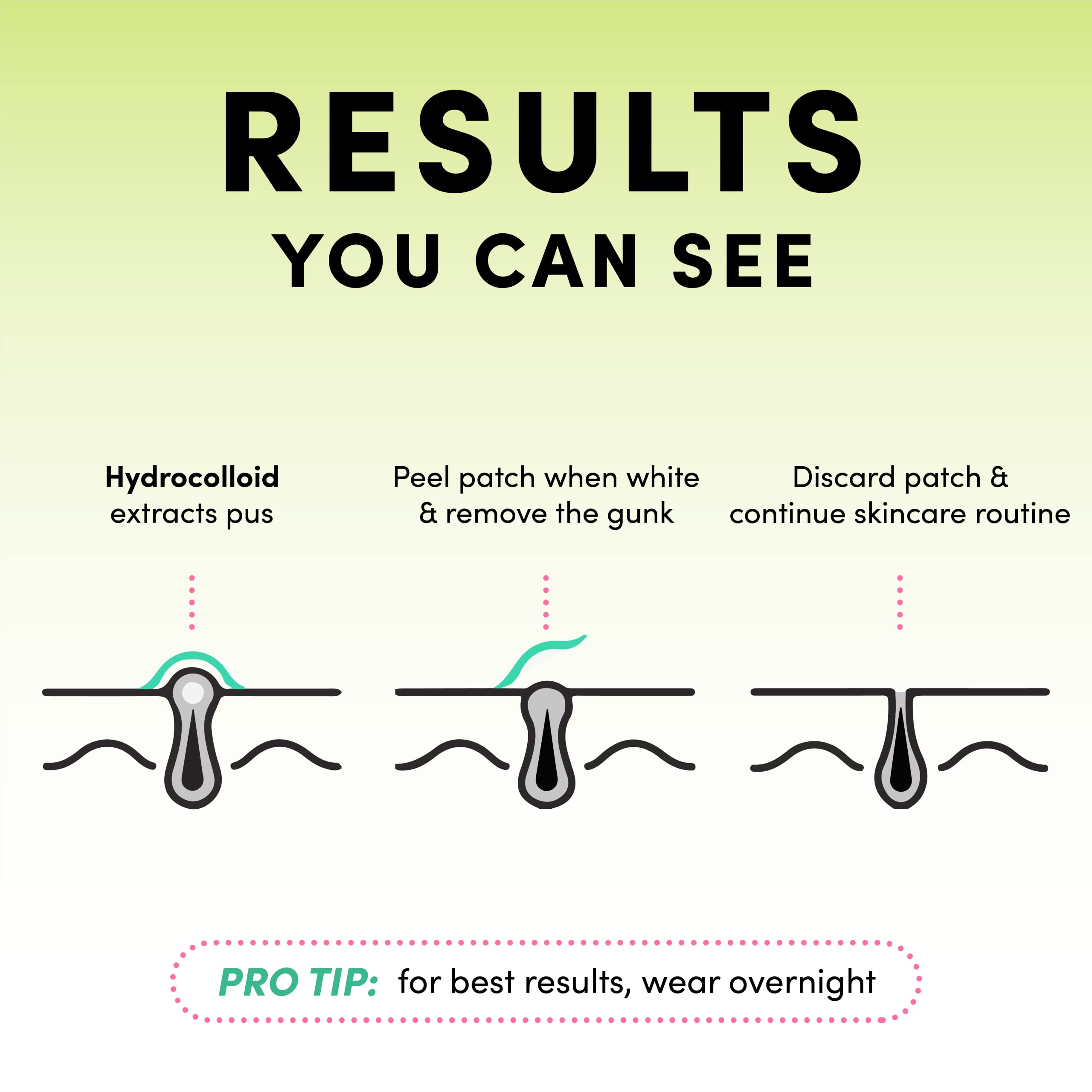 Dots for Spots pimple patches on skin provide clear centre visibility during wear and overnight use.