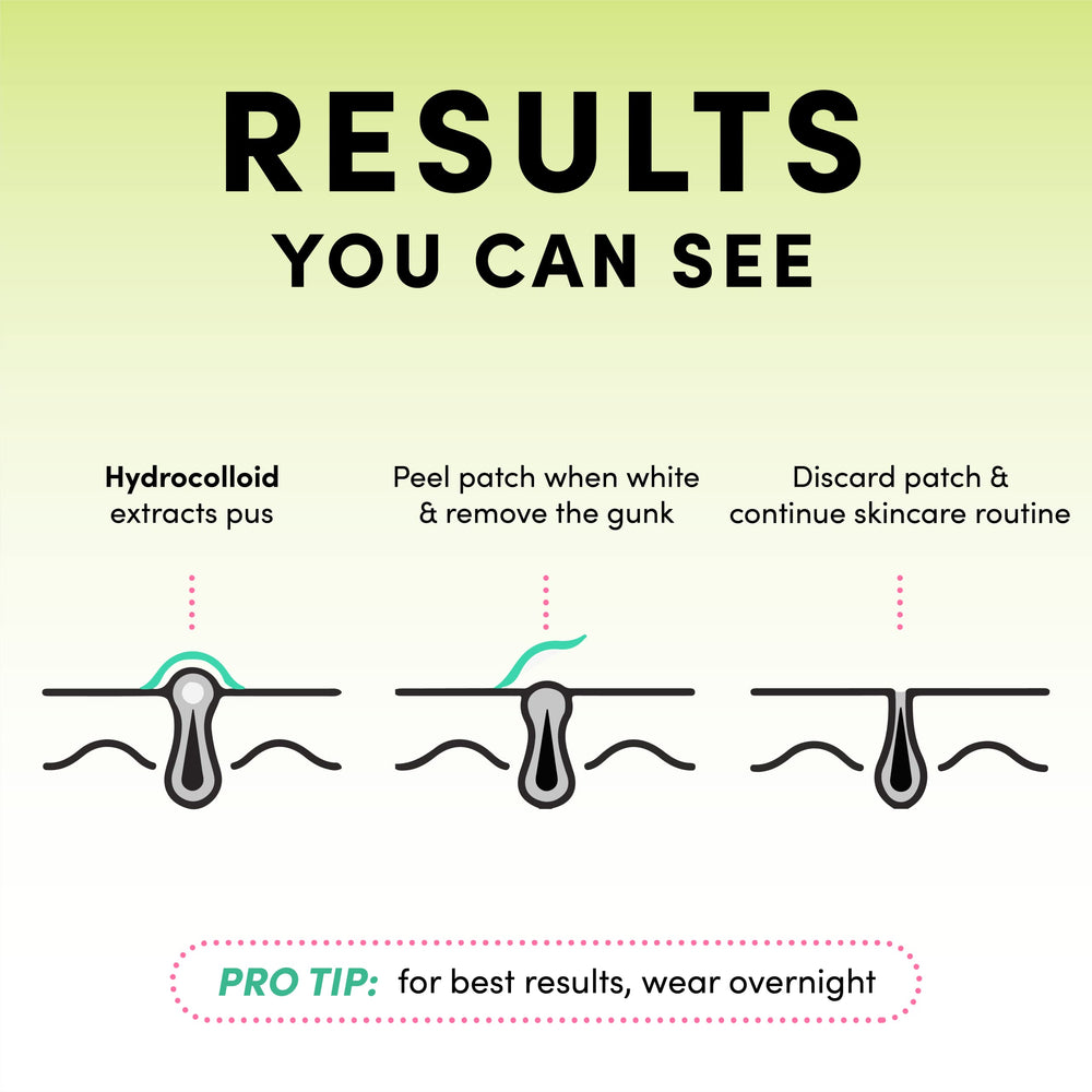 Dots for Spots pimple patches on skin provide clear centre visibility during wear and overnight use.