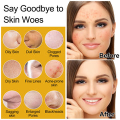 DOYEEWO skin-care-set-6pcs cleanser-lather shows rice-water cleansing for smooth skin