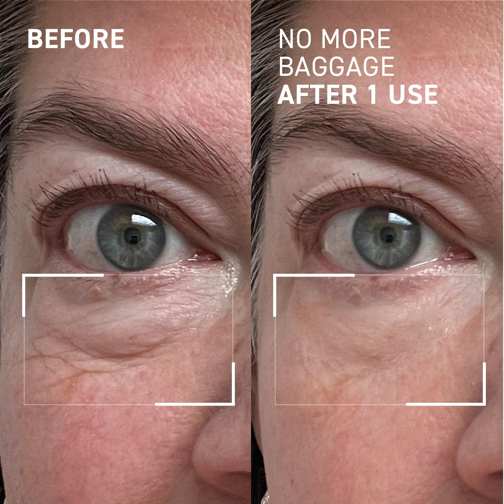 Dr. Brandt Needles No More fragrance-free formula on under-eye skin supports makeup wear.