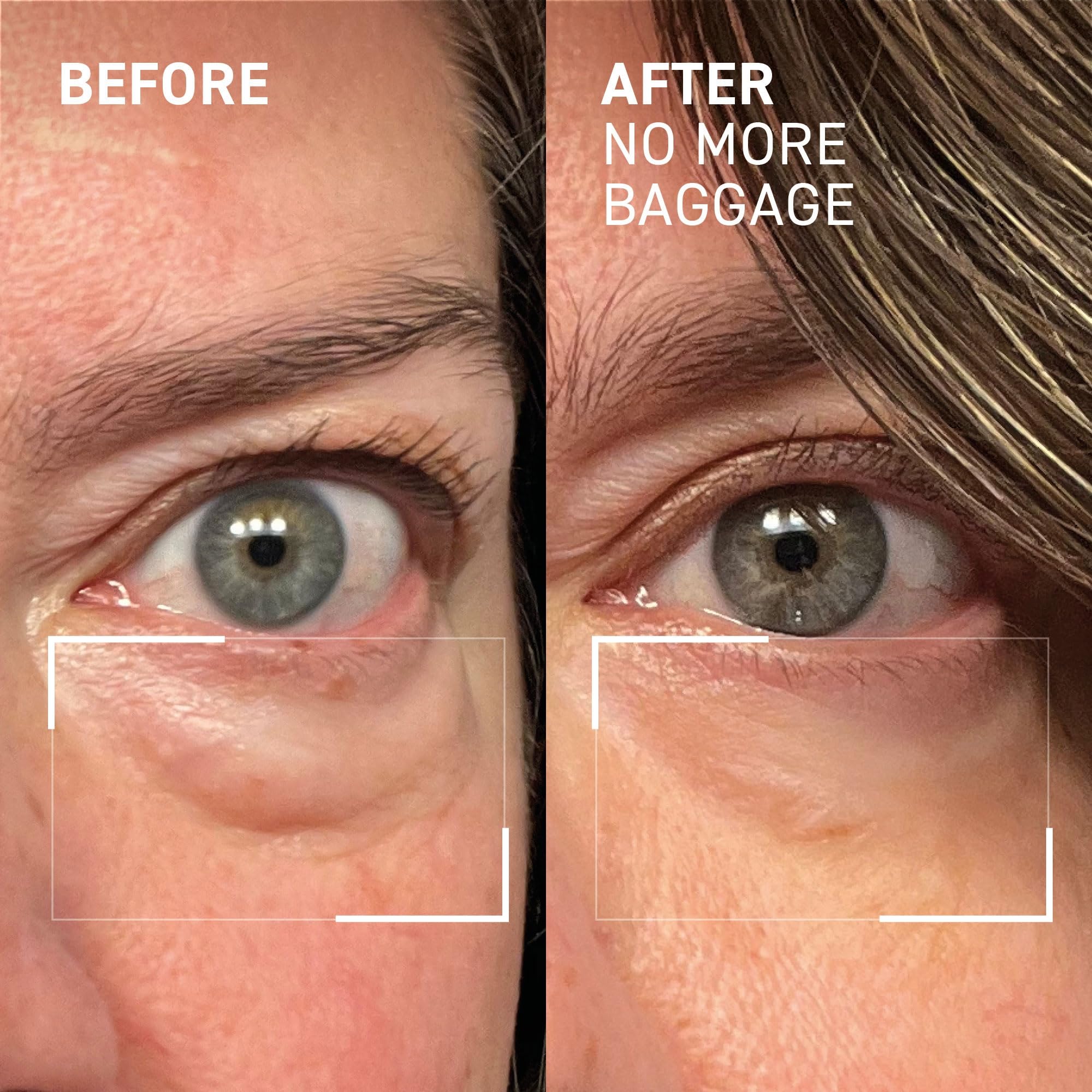 Dr. Brandt Needles No More is makeup-friendly in daily skincare routine.