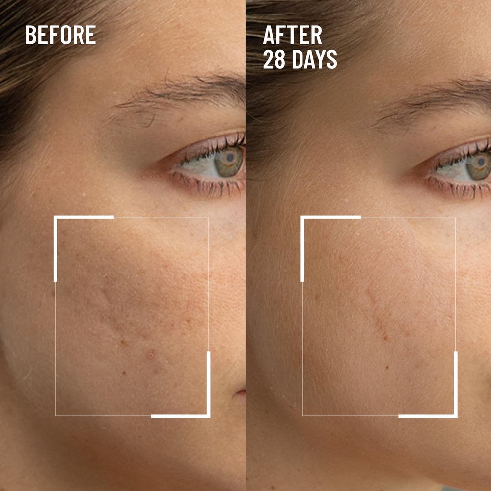 Dr. Brandt Skincare exfoliator cream texture close-up for radiant, even skin