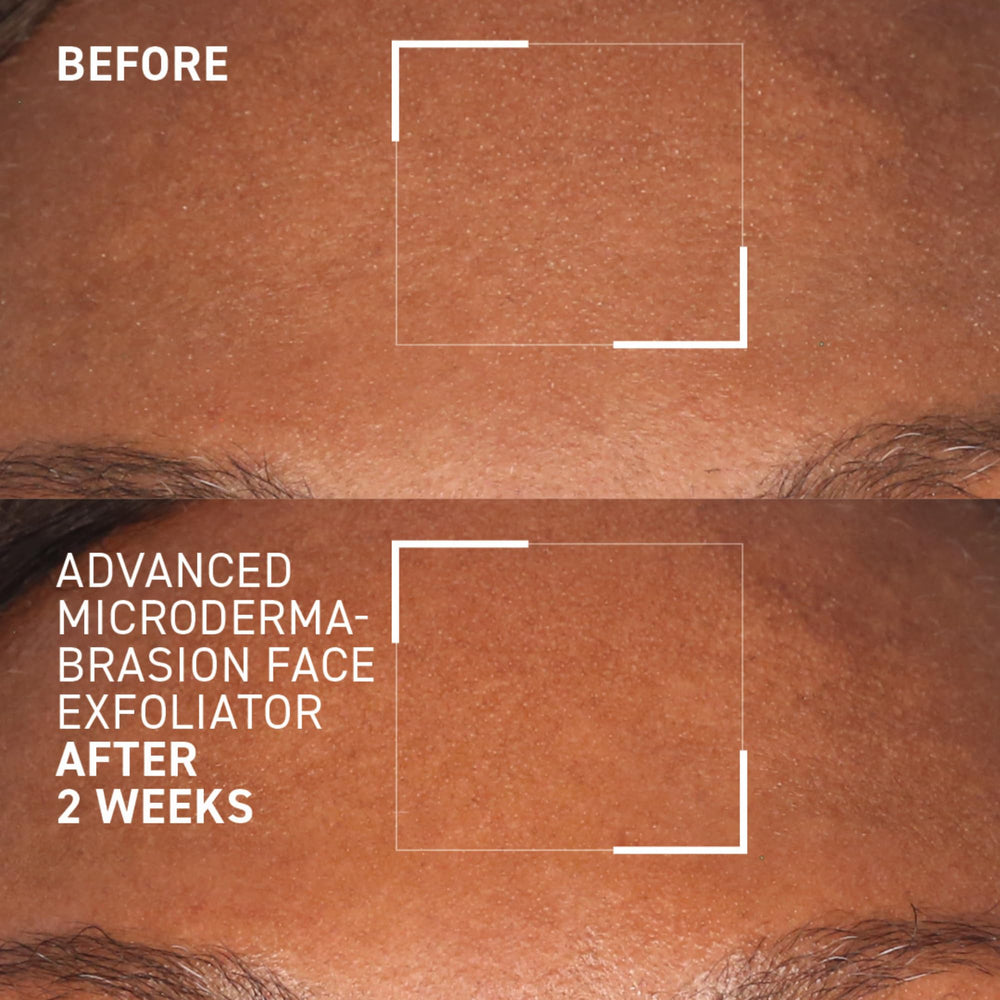 Dr. Brandt Skincare showing improved skin tone after exfoliation for even complexion.