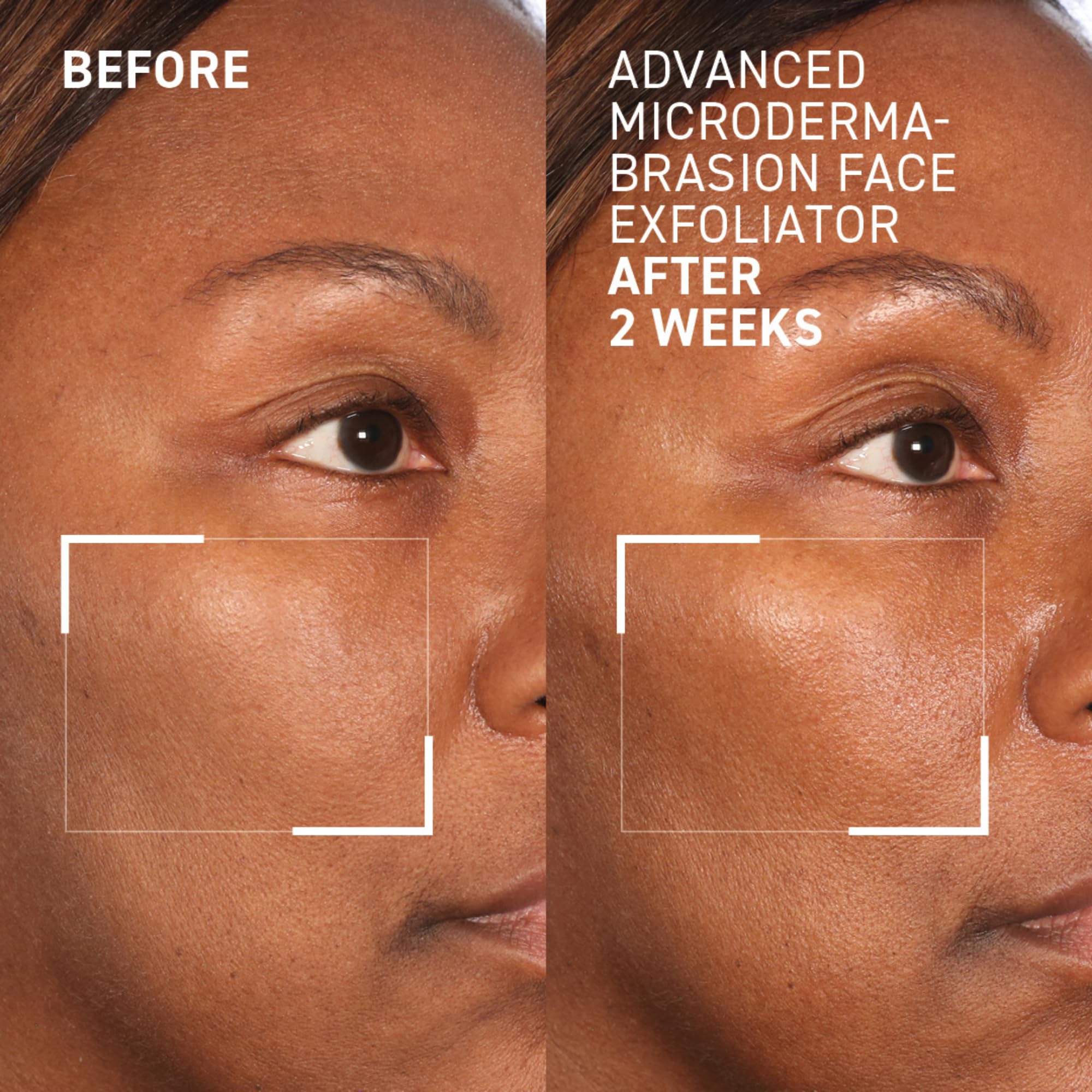 Texture closeup of Dr. Brandt Skincare exfoliator showing smooth surface effects.