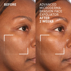 Texture closeup of Dr. Brandt Skincare exfoliator showing smooth surface effects.