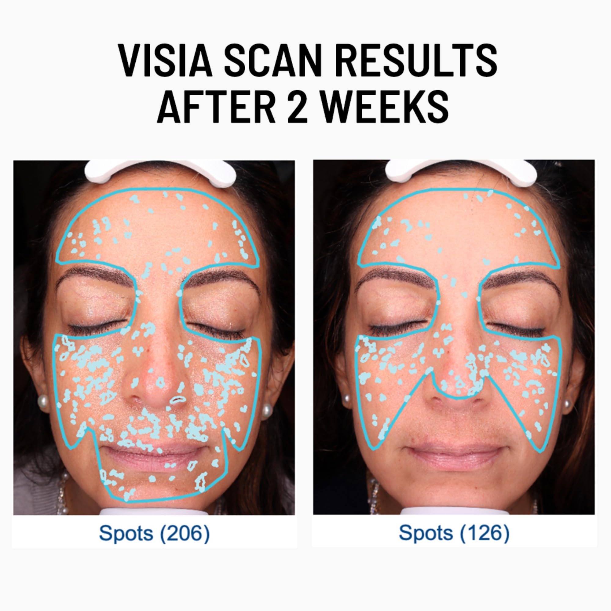 Damp skin application on Dr. Brandt Skincare exfoliator showing 2-minute massage steps.