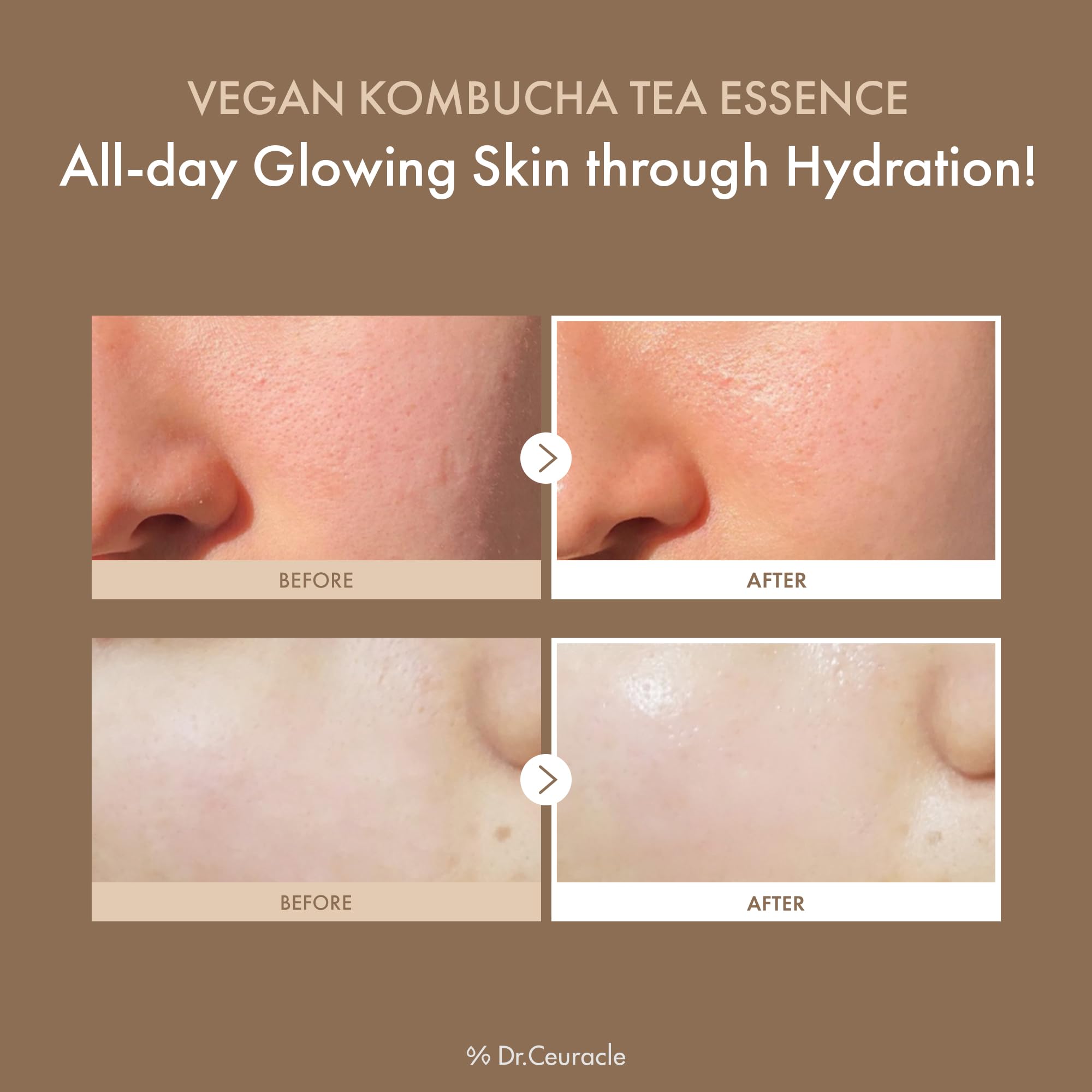 Dr.Ceuracle Vegan Kombucha Tea Essence bottle closeup texture shows milky hydration.