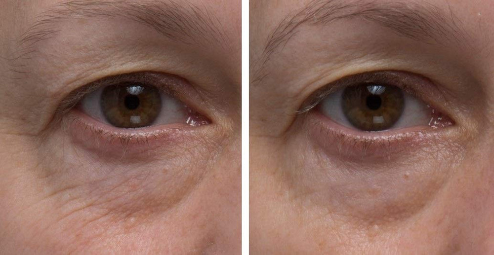 Dr. Denese SkinScience creamy texture glides on smoothly, ideal under makeup.