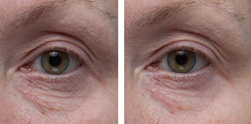 Dr. Denese SkinScience Hyaluronic Acid drops deliver lasting eye-area hydration.