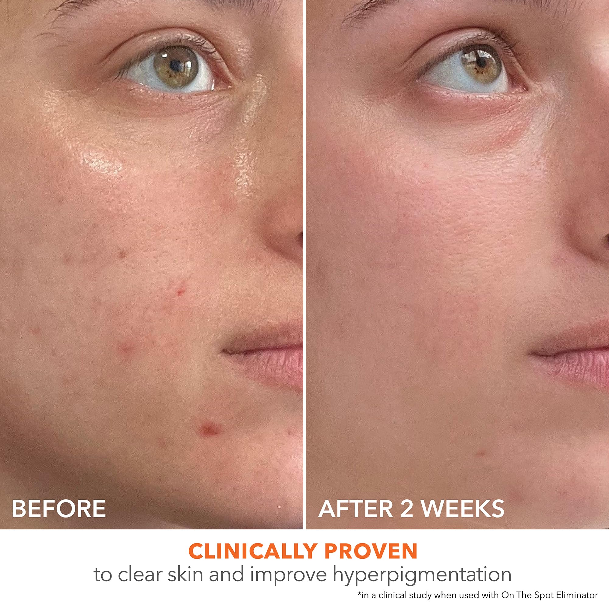 Dr Dennis Gross Alpha Beta packaging emphasizes dermatologist-founded safety and efficacy