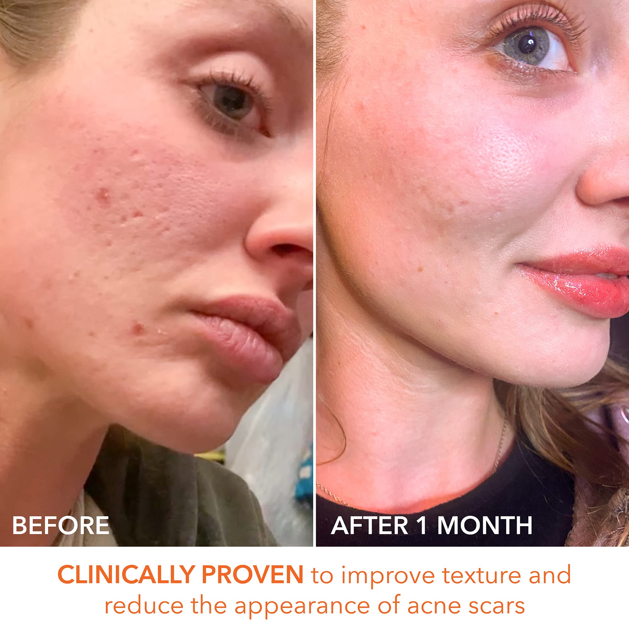 Dr Dennis Gross Alpha Beta Daily Peel in-use routine shows concise two-minute regimen