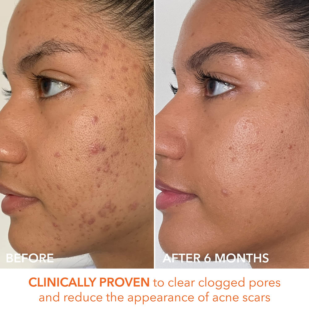 Packaging arrangement for Dr Dennis Gross Alpha Beta Extra Strength Daily Peel