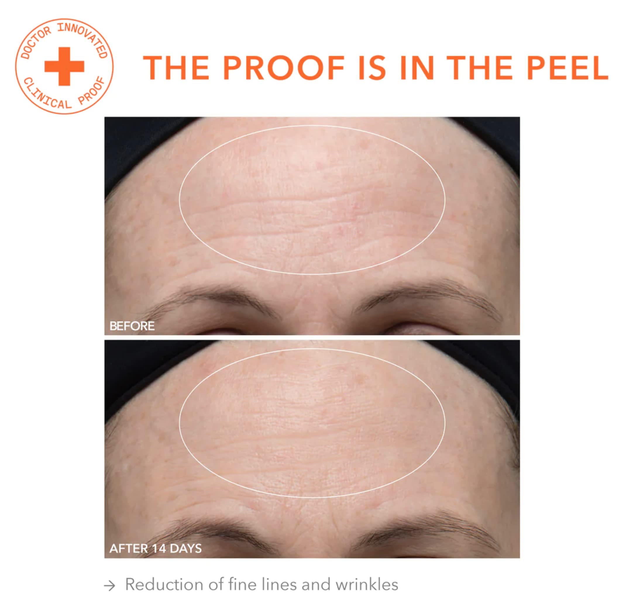 Dr Dennis Gross Alpha Beta Ultra Gentle Daily Peel close-up reveals radiant, even-toned skin.