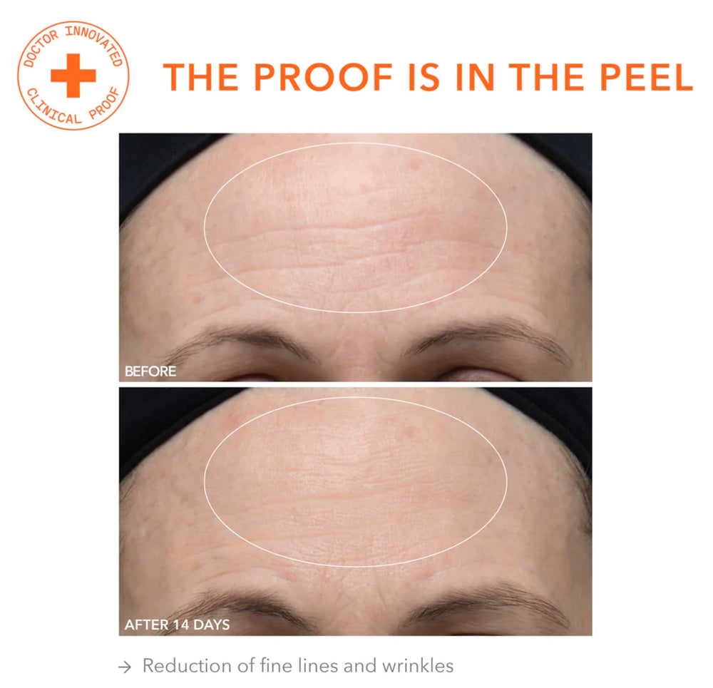 Dr Dennis Gross Alpha Beta Ultra Gentle Daily Peel close-up reveals radiant, even-toned skin.