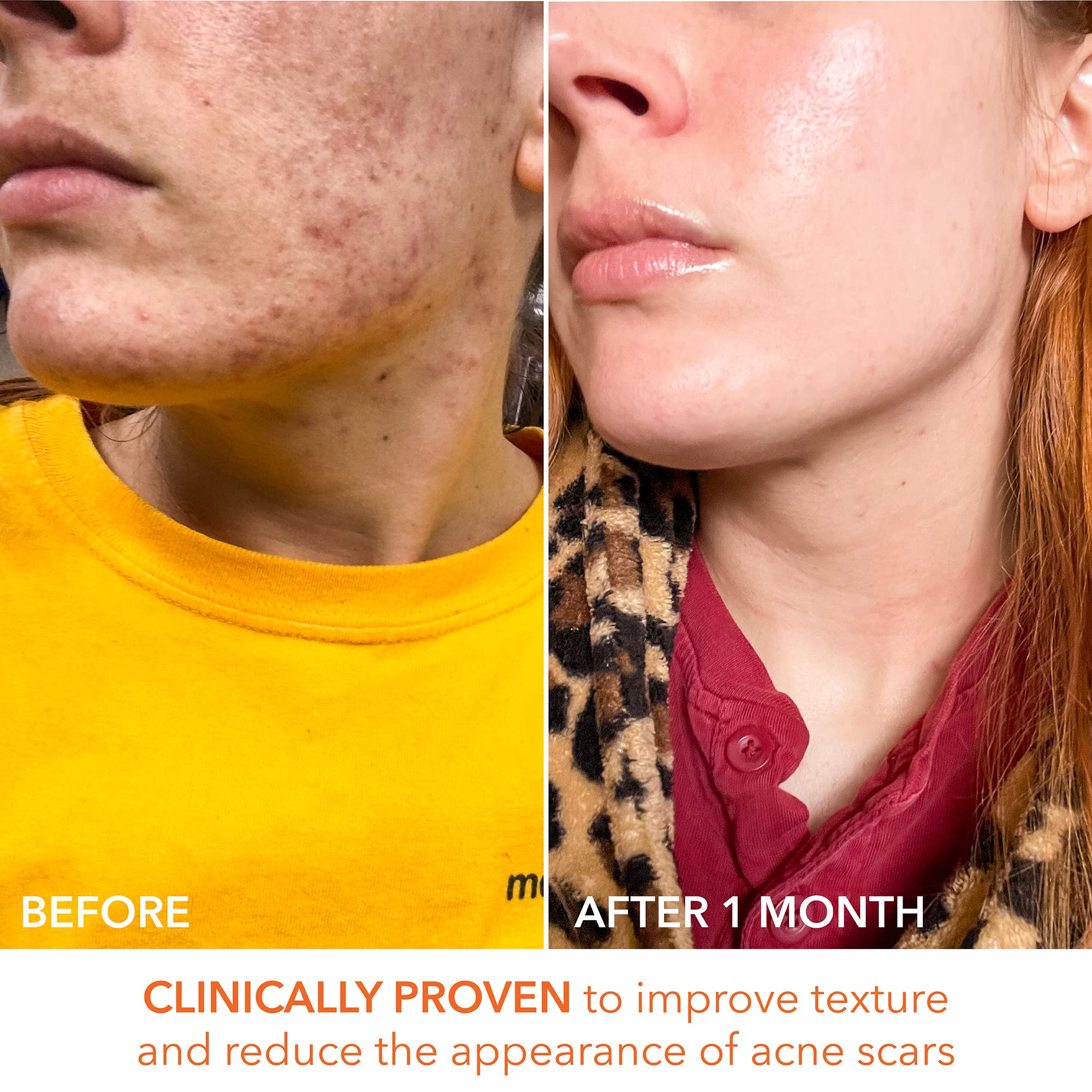 Morning routine with Alpha Beta Daily Peel for a radiant glow