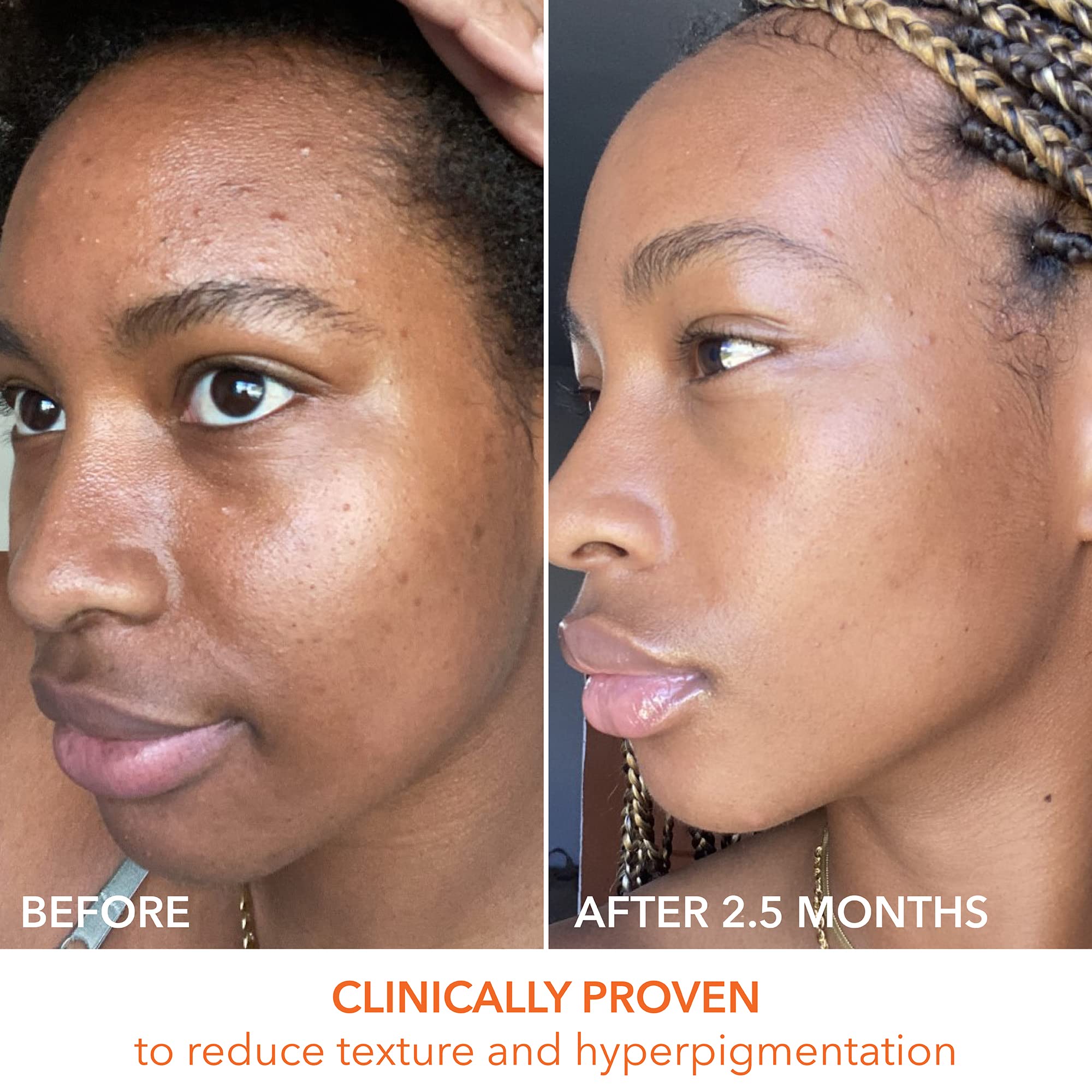 Two step daily peel ritual setup for easy skincare routine