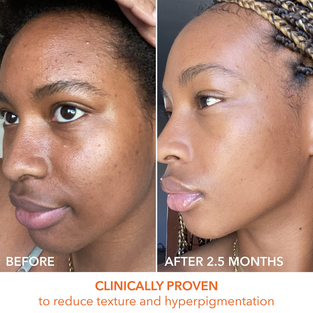 Two step daily peel ritual setup for easy skincare routine