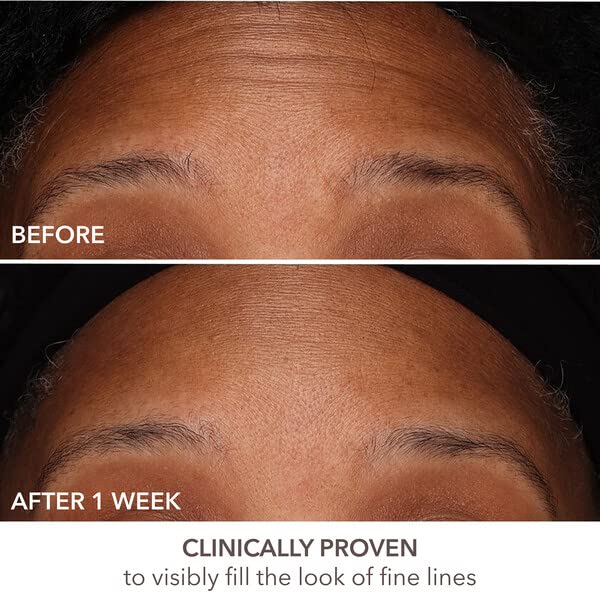 Peel and moisturizer pairing with DermInfusions for enhanced results