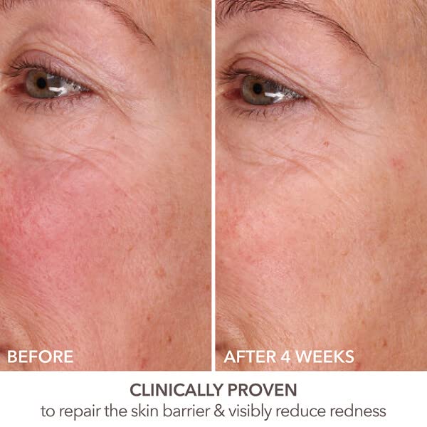 Application of DermInfusions with 2-3 pumps across the face