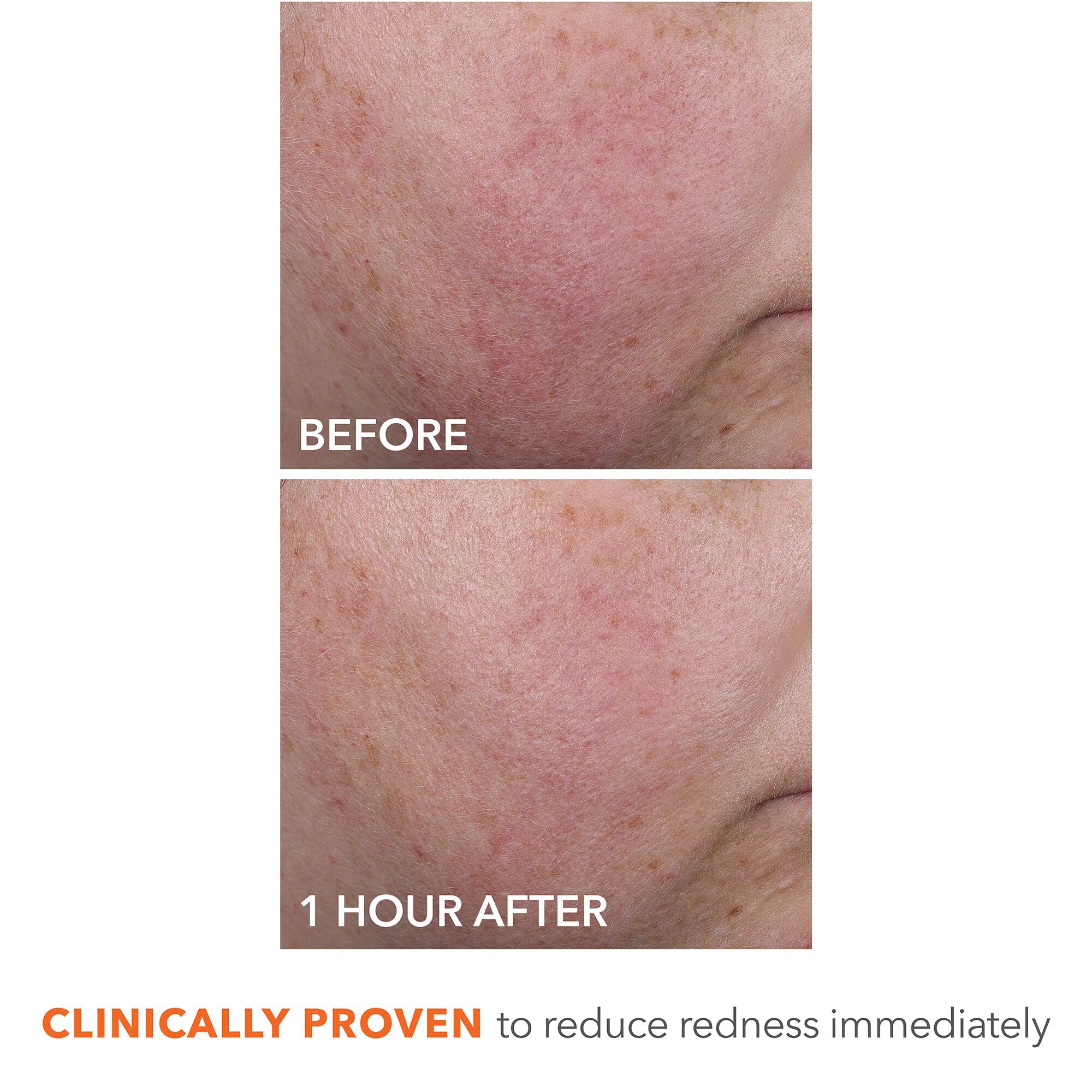 Dr Dennis Gross Blur + Repair Cream elasticity skin closeup hints at firming effects