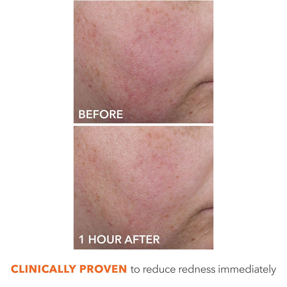 Dr Dennis Gross Blur + Repair Cream elasticity skin closeup hints at firming effects
