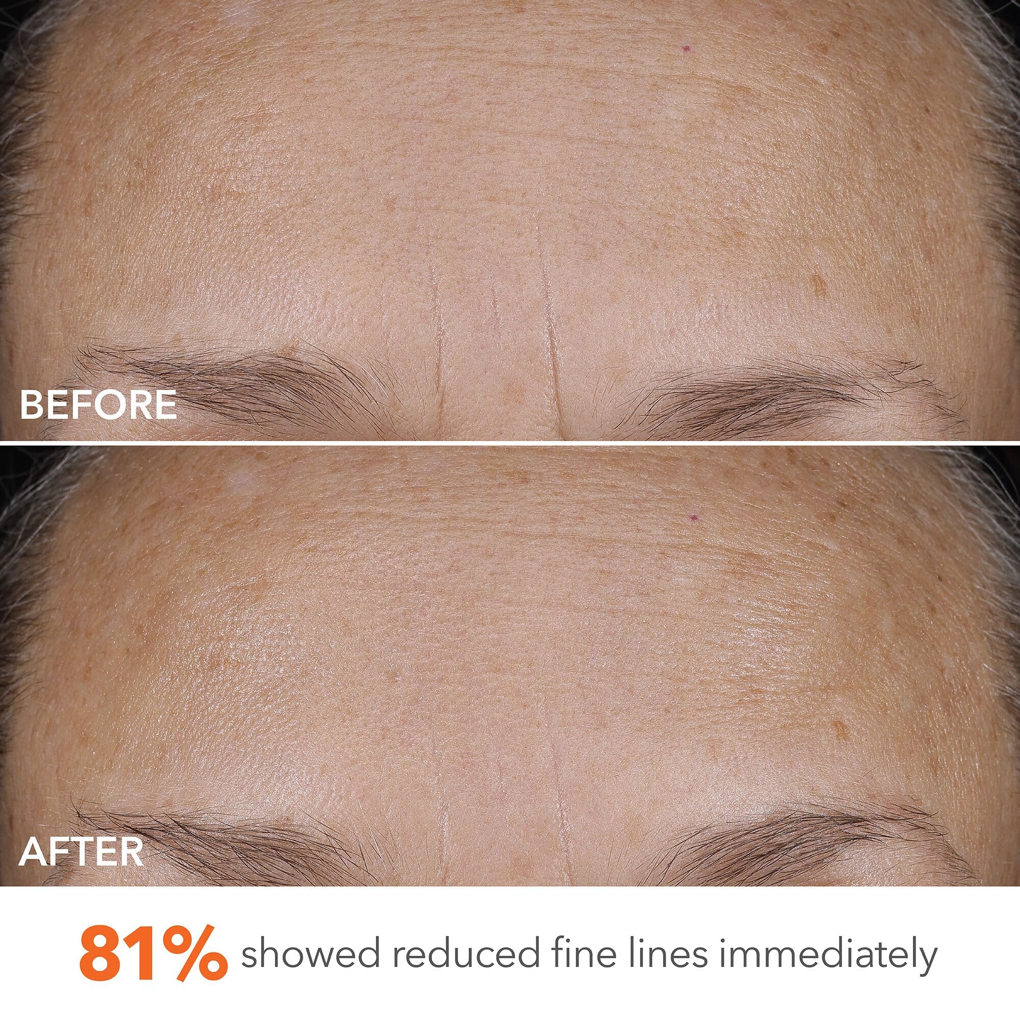 Dr Dennis Gross DermInfusions Blur + Repair Cream on skin during morning routine.