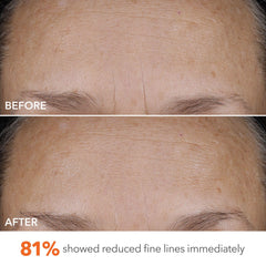 Dr Dennis Gross DermInfusions Blur + Repair Cream on skin during morning routine.
