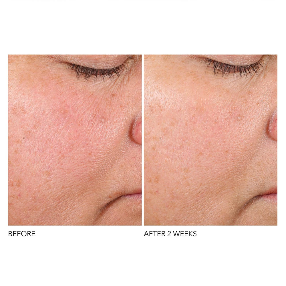 Dr. Dennis Gross hydration boost with squalane and hyaluronic acid for supple skin