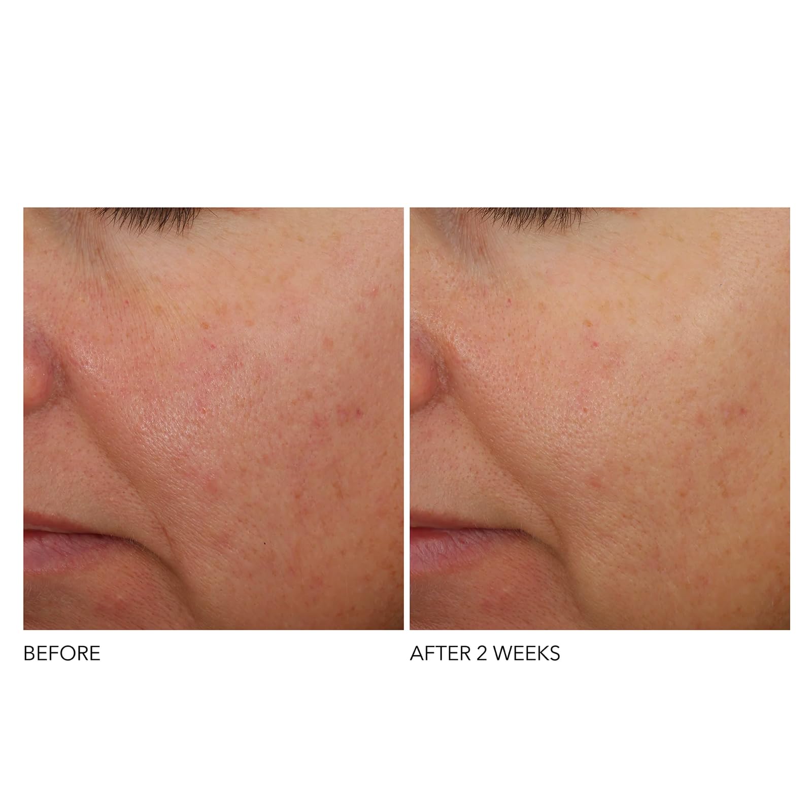 Dr Dennis Gross Overnight application shot illustrating calm, consistent nightly routine.